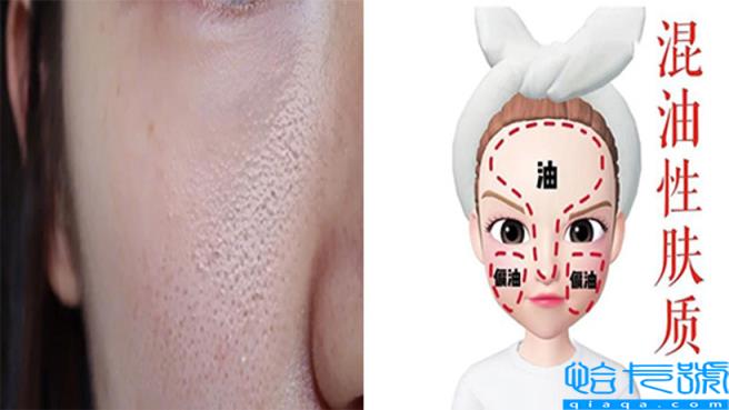 混油皮和混干皮的区别(如何判断自己混油还是油皮)
