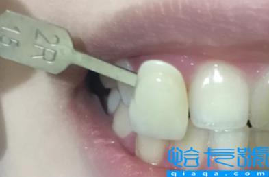 拍片有智齿一定会长吗(拍片有智齿一定要拔吗)