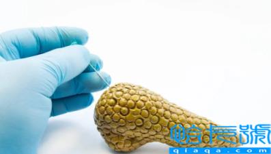 胰腺癌刚刚就发现了有救吗(胰腺癌刚发现到死要多长时间)