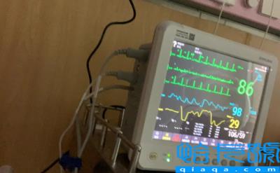 胰腺上长瘤意味着什么(胰头肿瘤发展多快)