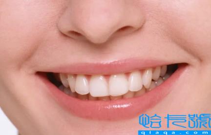 唇部脱毛的价格多少(唇部脱毛的价格为什么差这么多)