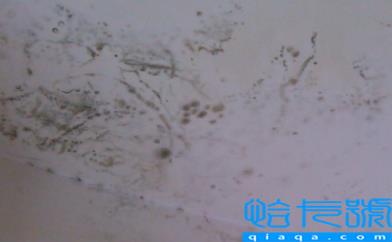 板楼的房子漏雨吗(老旧小区房屋漏水谁来负责维修)