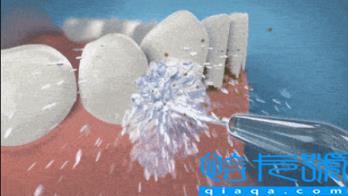 美容医院洗牙靠谱吗(​洗牙去美容院好还是口腔医院好)