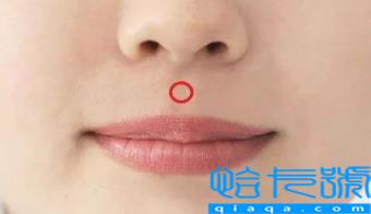 人中上的痣能去掉吗(人中上的痣代表什么)