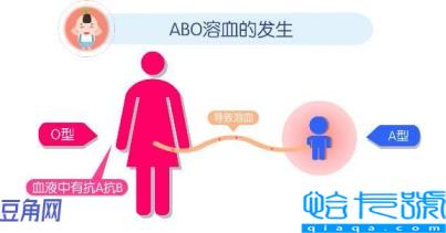 血型遗传规律表(abo血型遗传规律表)