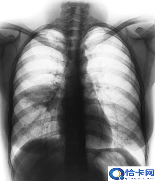 windows7开机(win7sao开机)