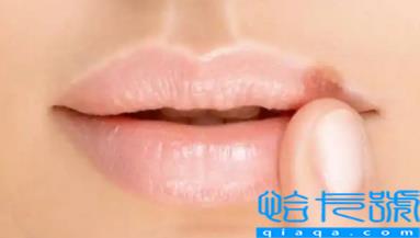 嘴唇疱疹结痂了能见水吗(嘴唇疱疹流水结痂怎么处理)