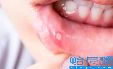 嘴唇疱疹会越来越多吗(嘴唇疱疹严重的话会怎么样)