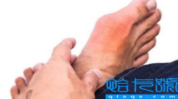 免疫吸附治痛风是用机器吗(免疫吸附治痛风的利弊)