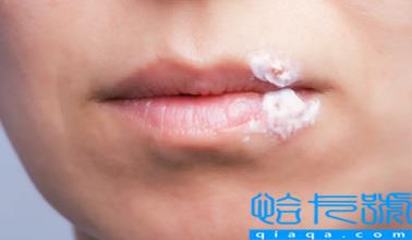 口唇疱疹结痂了怎么好得快(唇疱疹结痂后还需要注意什么)