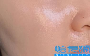 每晚用杏仁油擦脸变白怎么回事(用杏仁油擦脸会不会有副作用)