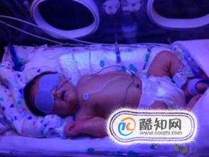 新生儿总是睡觉不吃奶怎么办(新生儿光睡觉不吃奶怎么办)