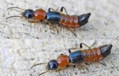 隐翅虫引起的皮炎特别疼！(隐翅虫皮炎初期图片)