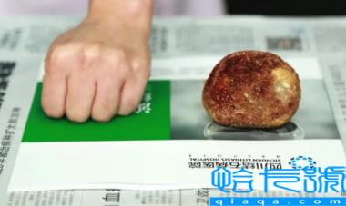 肾结石3mm需要吃药吗(肾结石3mm会引起腰疼吗)