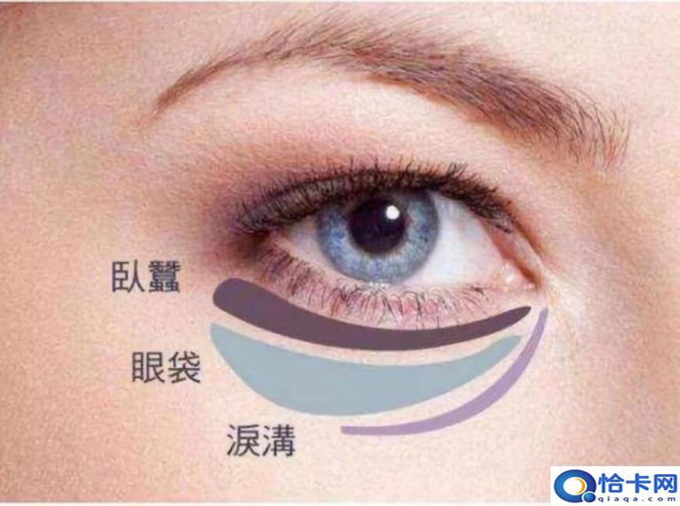 鱼尾纹怎么祛(淡化鱼尾纹最有效的方法)